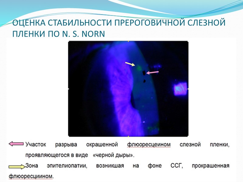 КЛАССИФИКАЦИЯ  (Сомов Е.Е., Бржеский В.В.,1998 г с изменениями) По этиологии -синдромальный -симптоматический, который