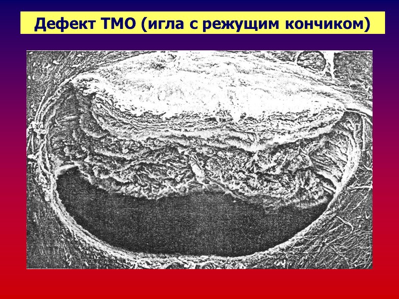 Госпитализация в хирургическую клинику 1  ЭТАП Для  выполнения плановой операции  Для