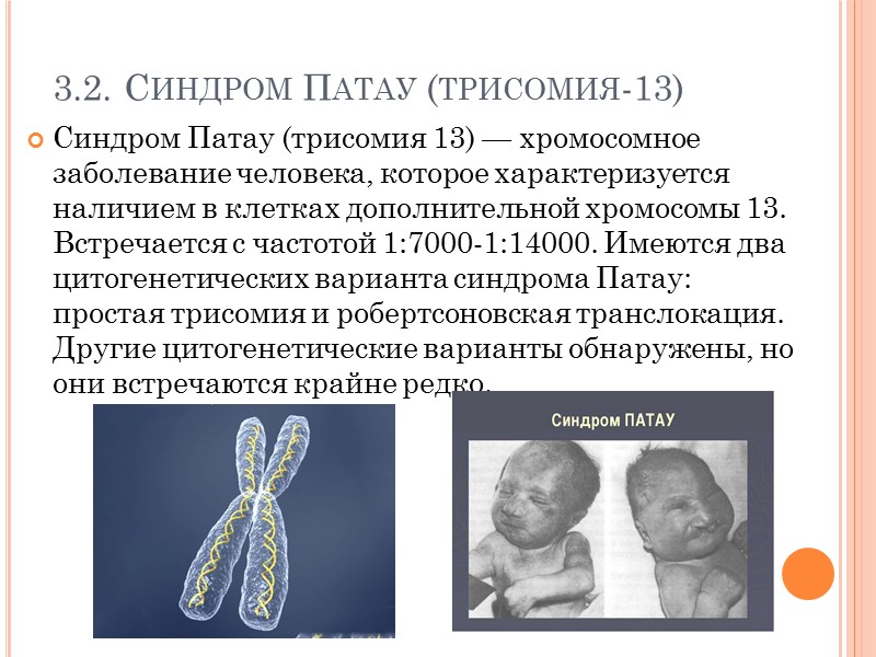 Хромосомные заболевания дауна. Синдром Патау трисомия по 13 хромосоме. Хромосомные болезни Патау. Синдром Патау (трисомия 13-й хромосомы). Синдром Дауна (трисомия по 21 паре хромосом).