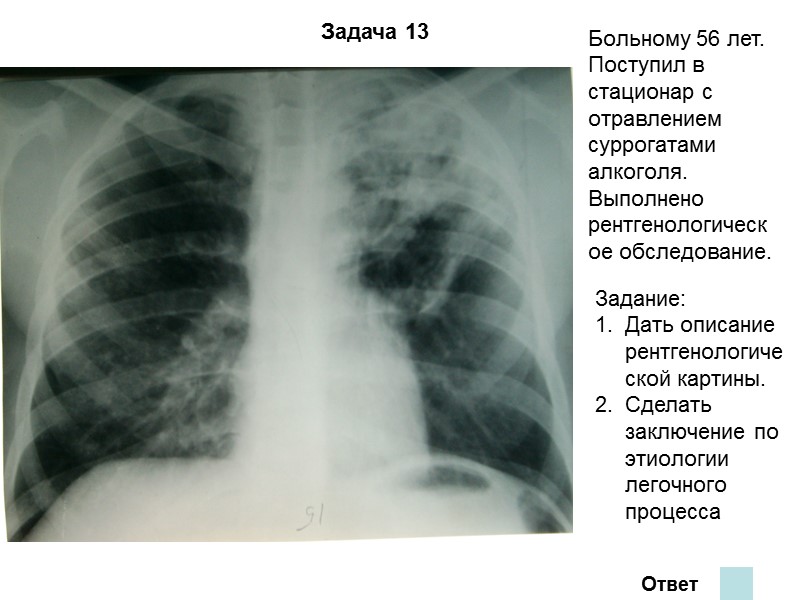 Задача 9 Ответ На обзорной рентгенограмме и томограммах легких синдром легочной диссеминации.  Множественные