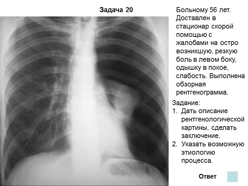 Задача 17 Ответ На обзорной рентгенограмме синдром легочной диссеминации. В верхних и средних отделах