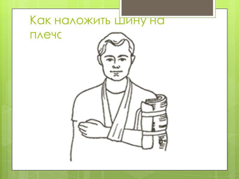 Травматический шок В развитии ТШ различают две фазы -возбуждение и торможение.  Фаза возбуждения