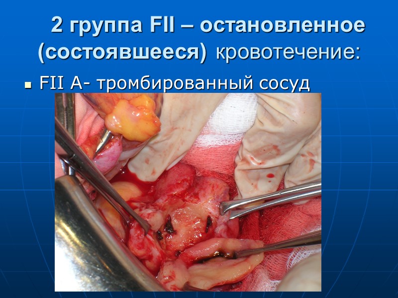 Количество больных находящихся на лечении в центре желудочно-кишечных кровотечений г. Днепропетровска