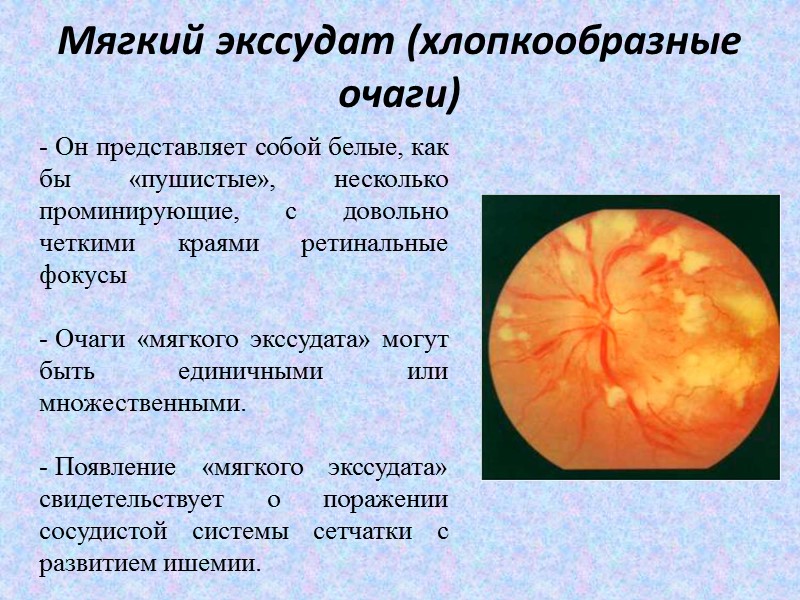 Топографическая анатомия глазного дна  Центральная артерия сетчатки (d=0,4-0,9 мм у взрослых и 0,2-0,4