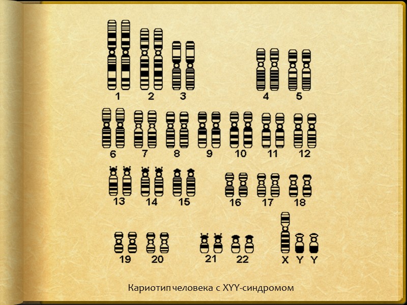 >Кариотип человека с XYY-синдромом