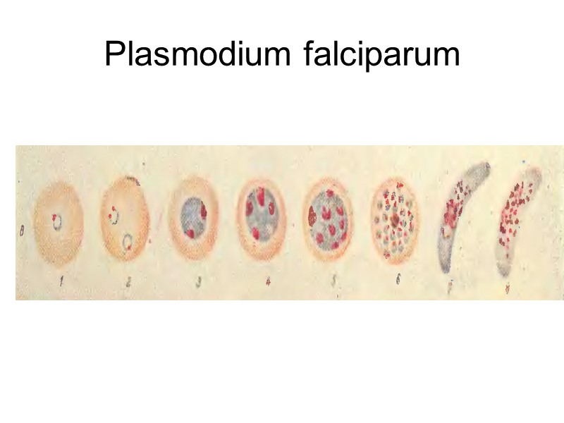 Plasmodium malariae в толстой капле значительно менее изменен, чем Plasmodium vivax. Кольца этих видов