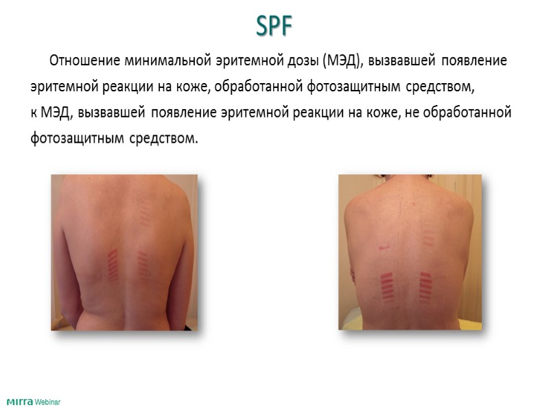 Содержание МДА в коже под действием  ПОЛИВИТАМИННОГО БАЛЬЗАМА
