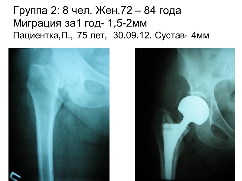 Contour GT-K Optical Profiling System Sample №2 (Ti покрыт Zr+полировка) 3D image in Vertical