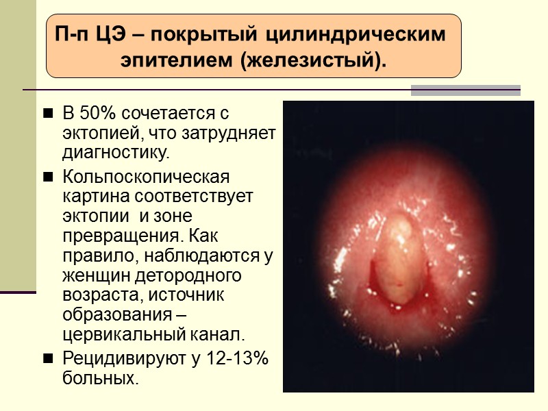 Эрозия с сильным воспалением (пациентка 31 год, 2 года принимает КОК)