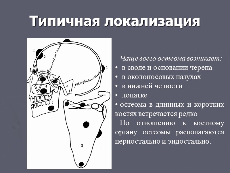 Признаки доброкачественности: Правильный структурный рисунок Признаки обызвествления и окостенения Четко очерченный контур Четкая отграничение