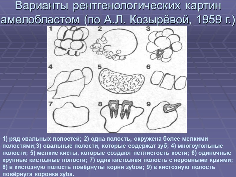 Клиническая картина амелобластомы