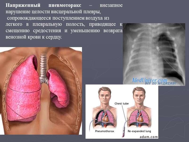 Внезапное нарушение