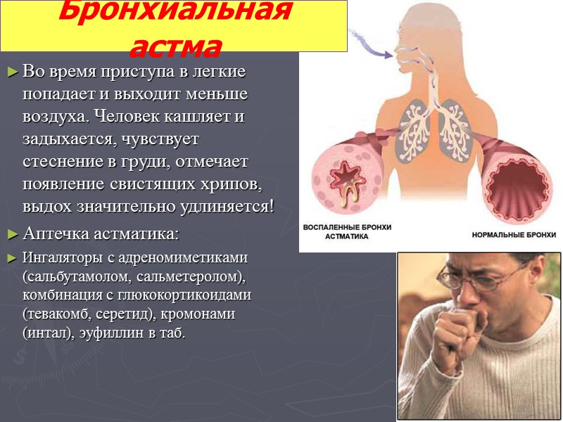 Пневмония воспаление легких вследствие разнообразных причин, среди которых — возбудители инфекции, химические раздражители и