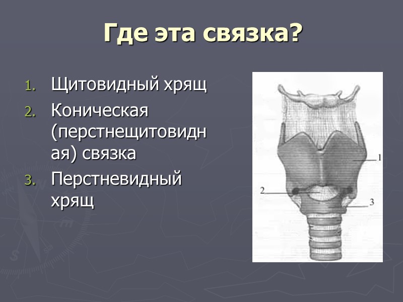 Располагают связками