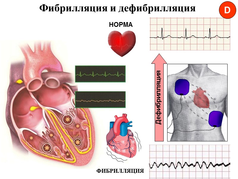 1. Скорейшее распознавание остановки сердца     и вызов бригады скорой медицинской