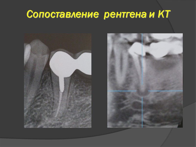 Рентген отличия