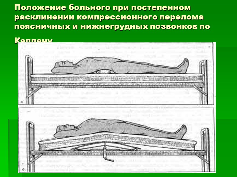 Почему нельзя сидеть при компрессионном переломе позвоночника