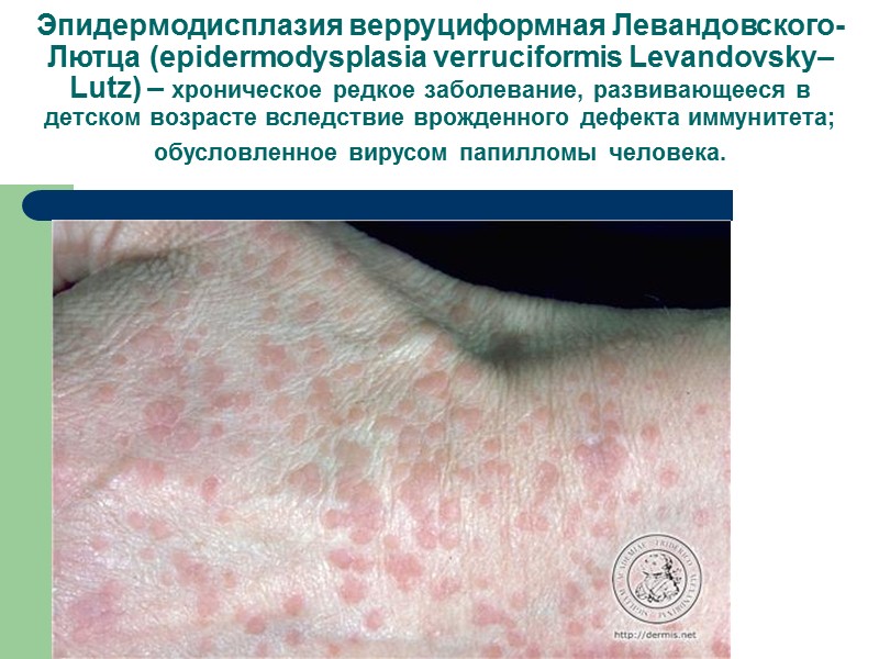 Предраковые заболевания кожи    – заболевание или патологический процесс, на фоне которого