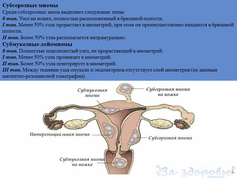Типичная гиперплазия эндометрия — пролиферация эндометриальных желёз без цитологической атипии. Простая типичная гиперплазия характеризуется