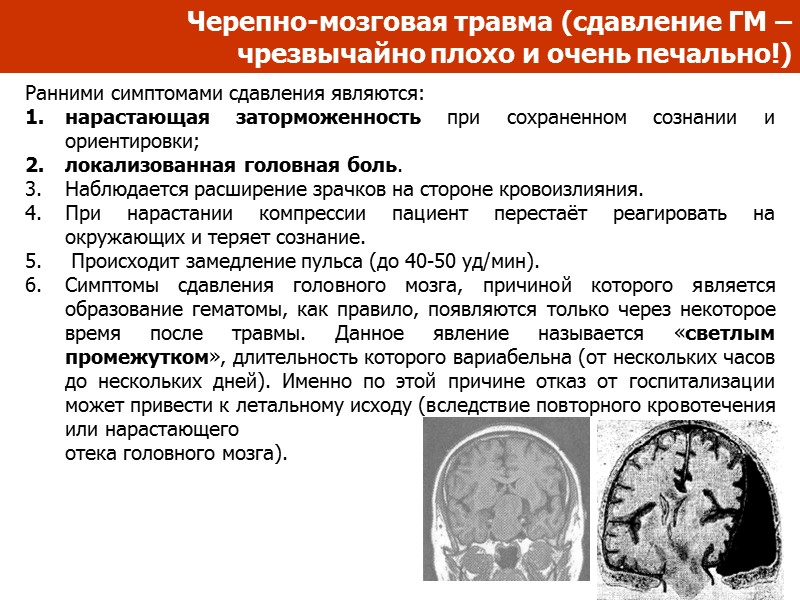 Черепно-мозговая травма Классификация черепно-мозговой  травмы: 1. Закрытая травма головного мозга (Повреждение нанесенное через