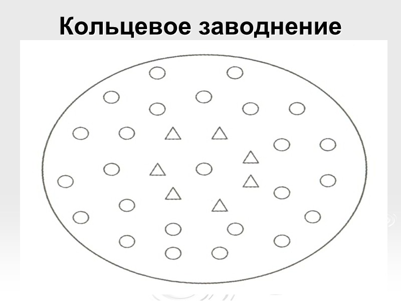 Схема «прямая закачка» на одну скважину с ЭЦН 1 – ВЗС; 2 – 