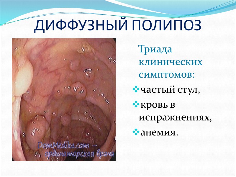 ЛИПОМА Имеет вид округлого или овального дефекта наполнения с четкими гладкими контурами диаметром от