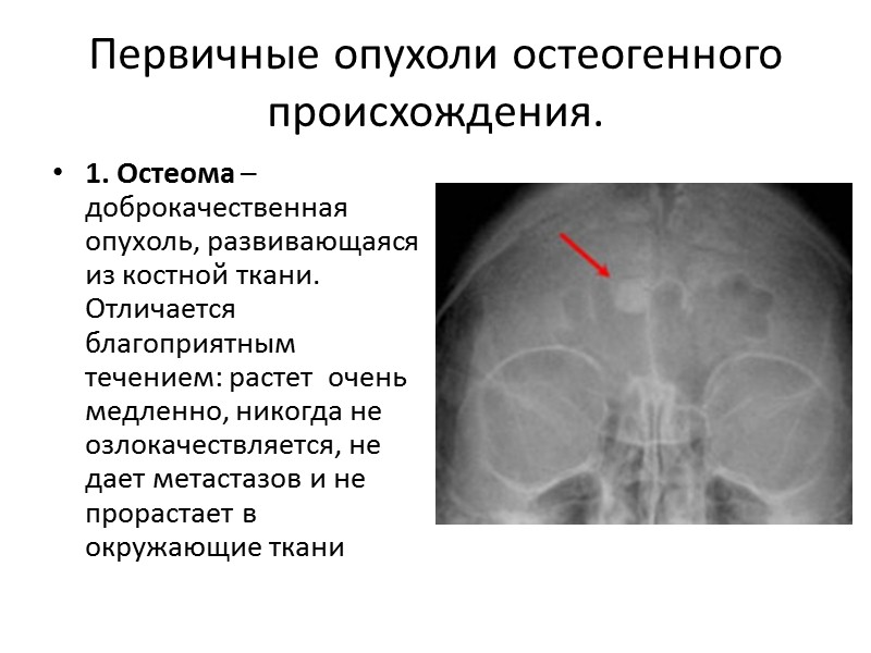 Первичные опухоли не остеогенного происхождения. Гемангио́ма (младенческая гемангиома) — это доброкачественная опухоль, состоящая из