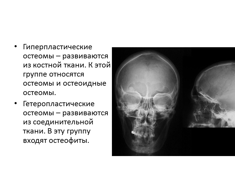 течении этого заболевания выделяют три стадии:  стадия активного роста (с рождения до 6-8