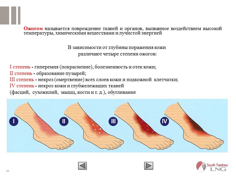 14 Остановка кровотечения сгибанием конечности  из сосудов предплечья , плеча, голени, стопы и