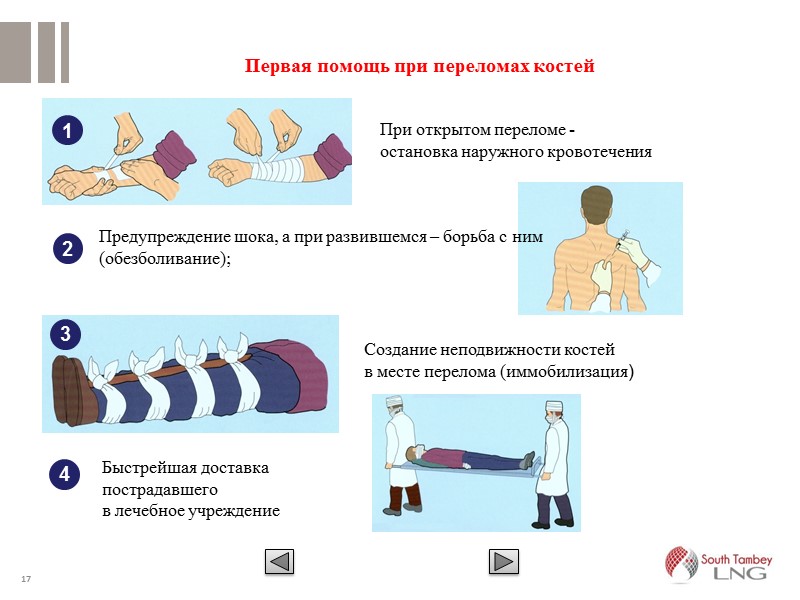 Переломы первая помощь презентация