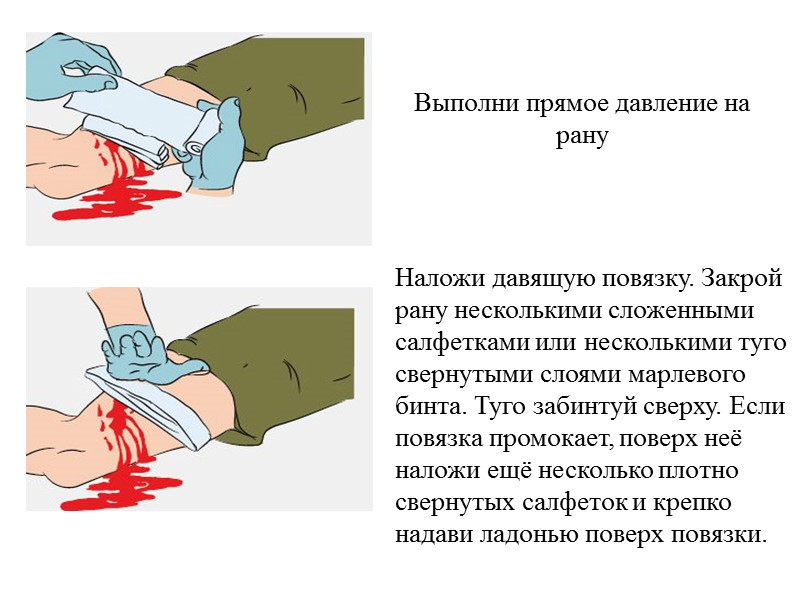 Встань позади у пострадавшего, наклони его вперед, основанием ладони нанеси 5 резких ударов между