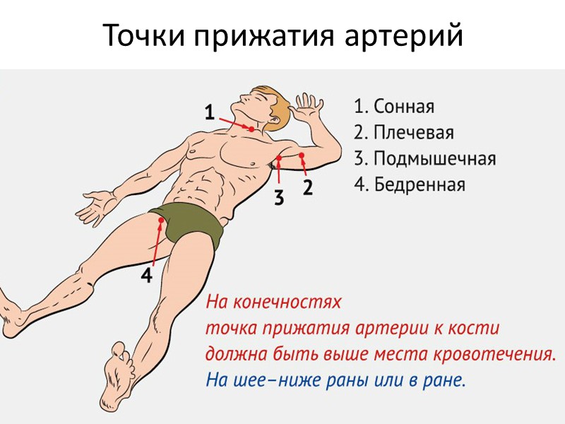 Перенос пострадавшего на носилках