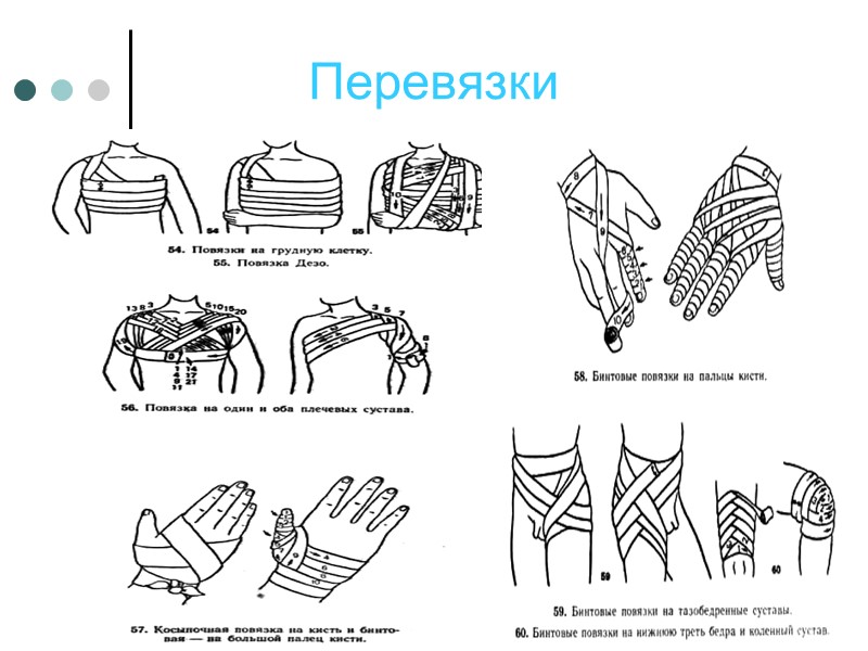 Ожоги    делятся на степени:       -