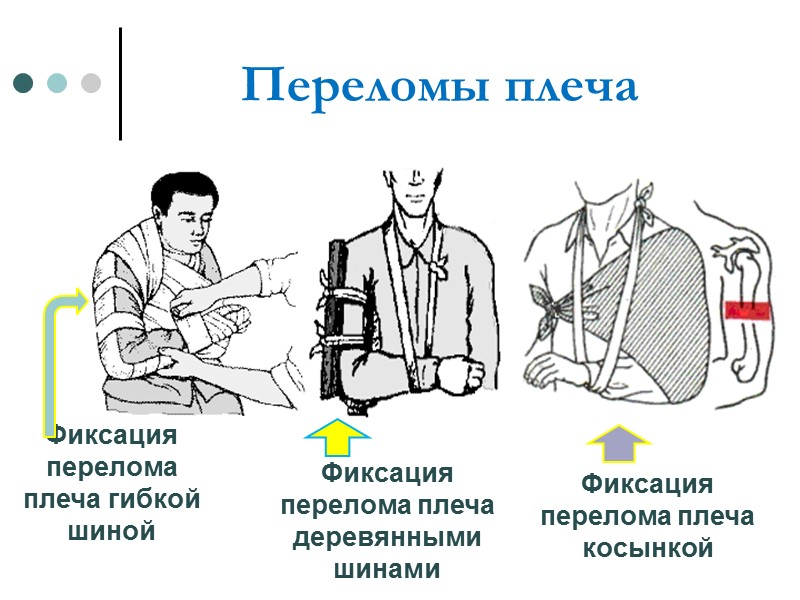 Первая помощь  Дать 1-3 стакана теплой воды, чтобы снизить концентрацию токсинов  Вызвать