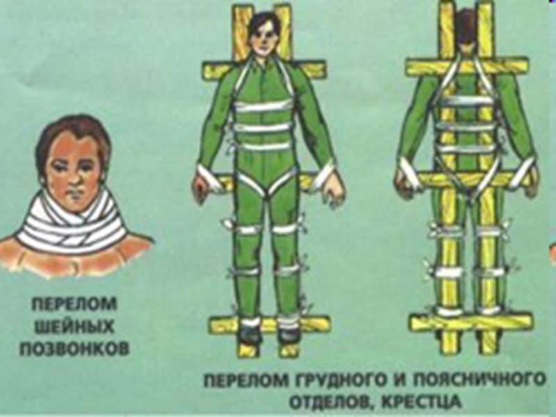 Первая помощь при укусе собаки и других зверей  Они могут болеть, потому надо