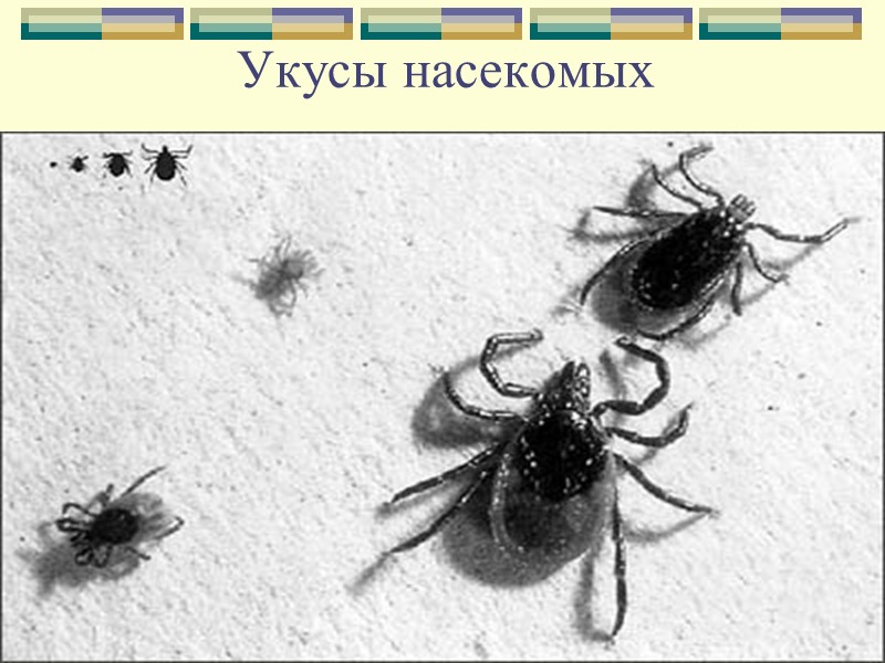 Первая помощь Положите пузырь со льдом на место ушиба.  Создайте покой организму. 