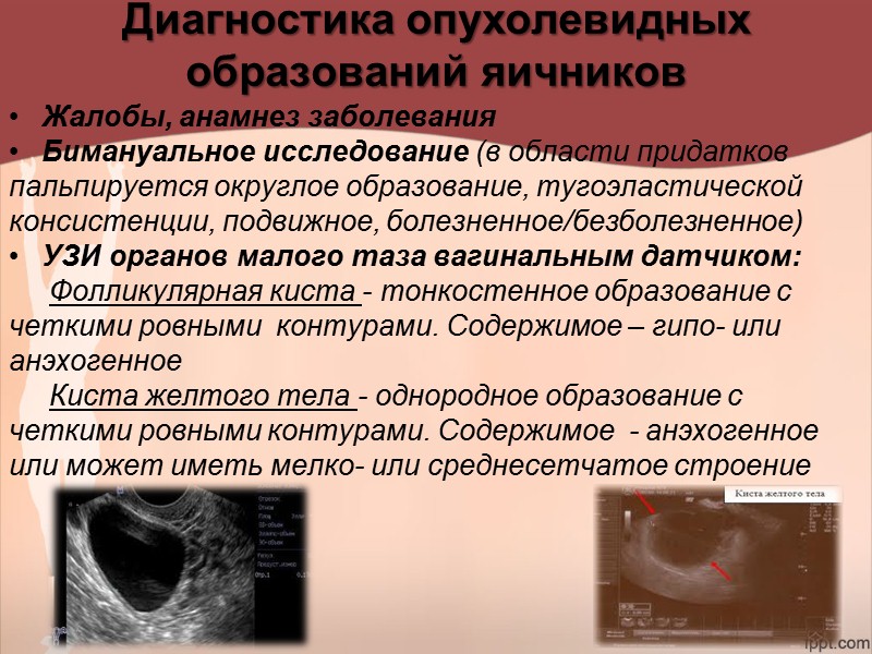 Рождение субмукозного миоматозного узла     Причины:     Субмукозный