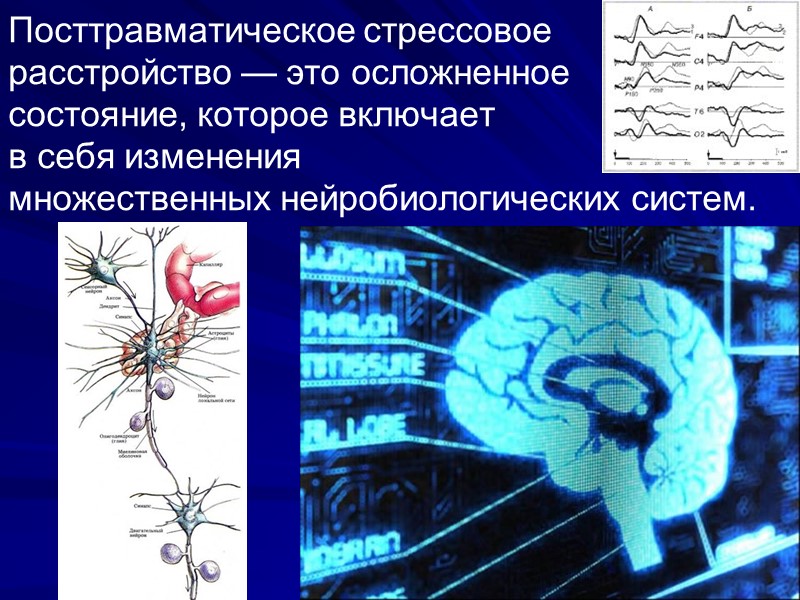 Показатели КИГ у детей с СПТС, вызванным военными действиями