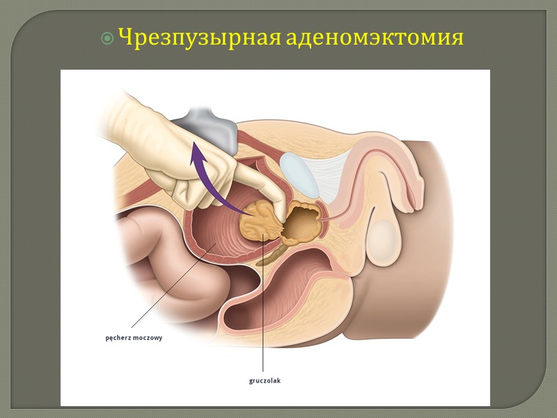 Анатомия железы Ткань состоит из желез ,погруженных в основу, состоящую главным образом из мышечной
