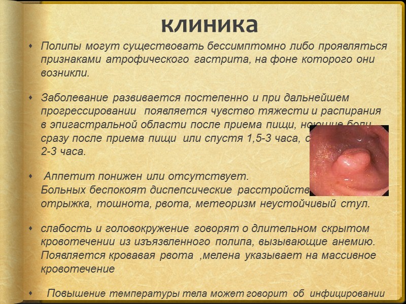 Этиология доброкачественного процесса Теория эмбриональной дистонии  Воздействие стрессогенных факторов Дисплазия эпителия Химические /