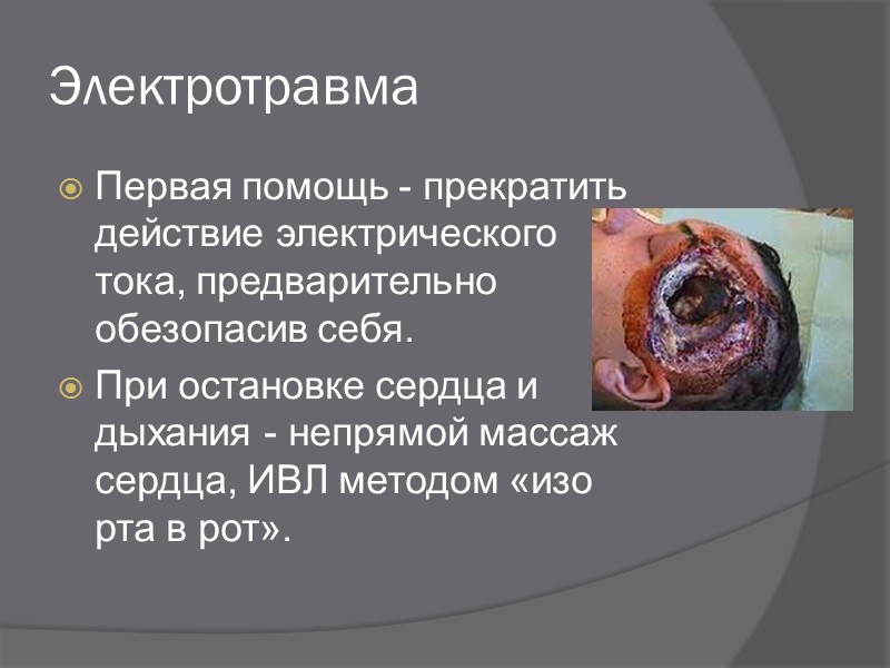 Ожоги Что нельзя делать: Прикасаться к ожогу руками Вскрывать волдыри, возникающие на коже; вскрытые