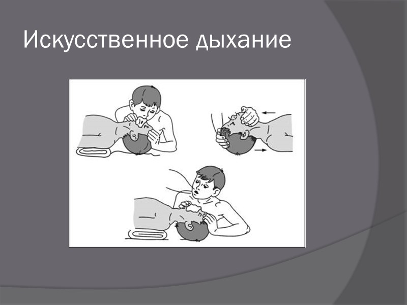 Признаки жизни Пульс Определяется на шее, где проходит самая крупная - сонная - артерия,