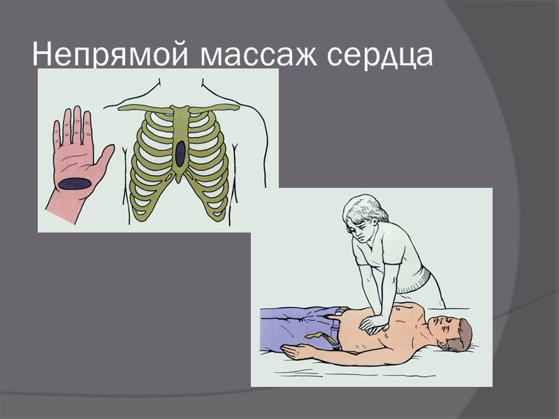 Искусственное дыхание