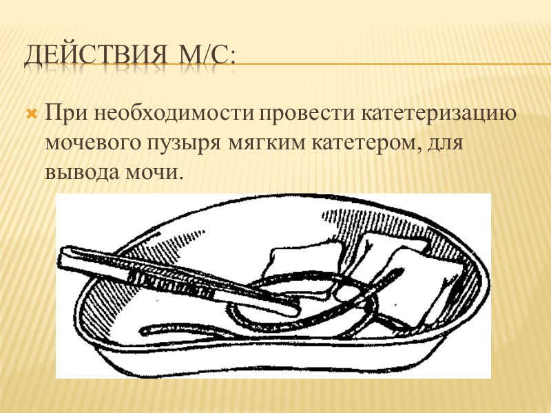 Действия м/с: При необходимости провести катетеризацию мочевого пузыря мягким катетером, для вывода мочи.