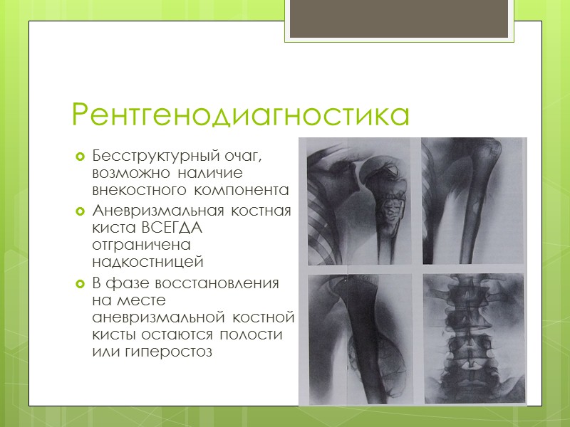 Доброкачественные опухоли костей презентация