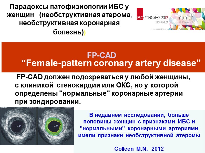 МОНИТОРИРОВАНИЕ  ПРОЦЕДУРЫ АНГИОПЛАСТИКИ   Cardiology Division,      