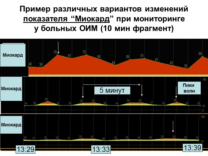 Выбранные  диагностические классы  из  “The PTB Diagnostic ECG Database”  