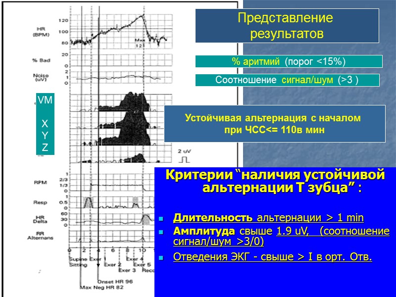 25 20 15  10 5 Обследованные группы больных  Т максимальн. (мкВ) P
