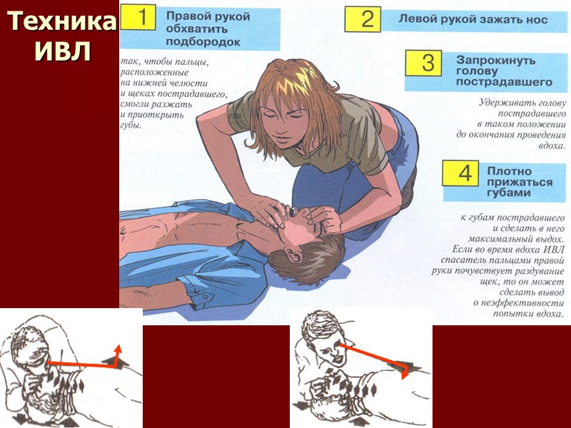Охранительное (восстановительное) положение Основная проблема: у пострадавшего без сознания, лежащего на спине, может западать