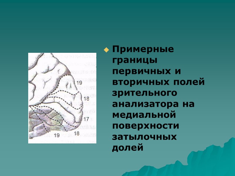 Оптико-пространственная агнозия  нарушение ориентировки в знакомом пространстве и в пространственных отношениях,  